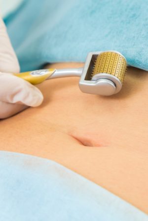 Mesotherapy